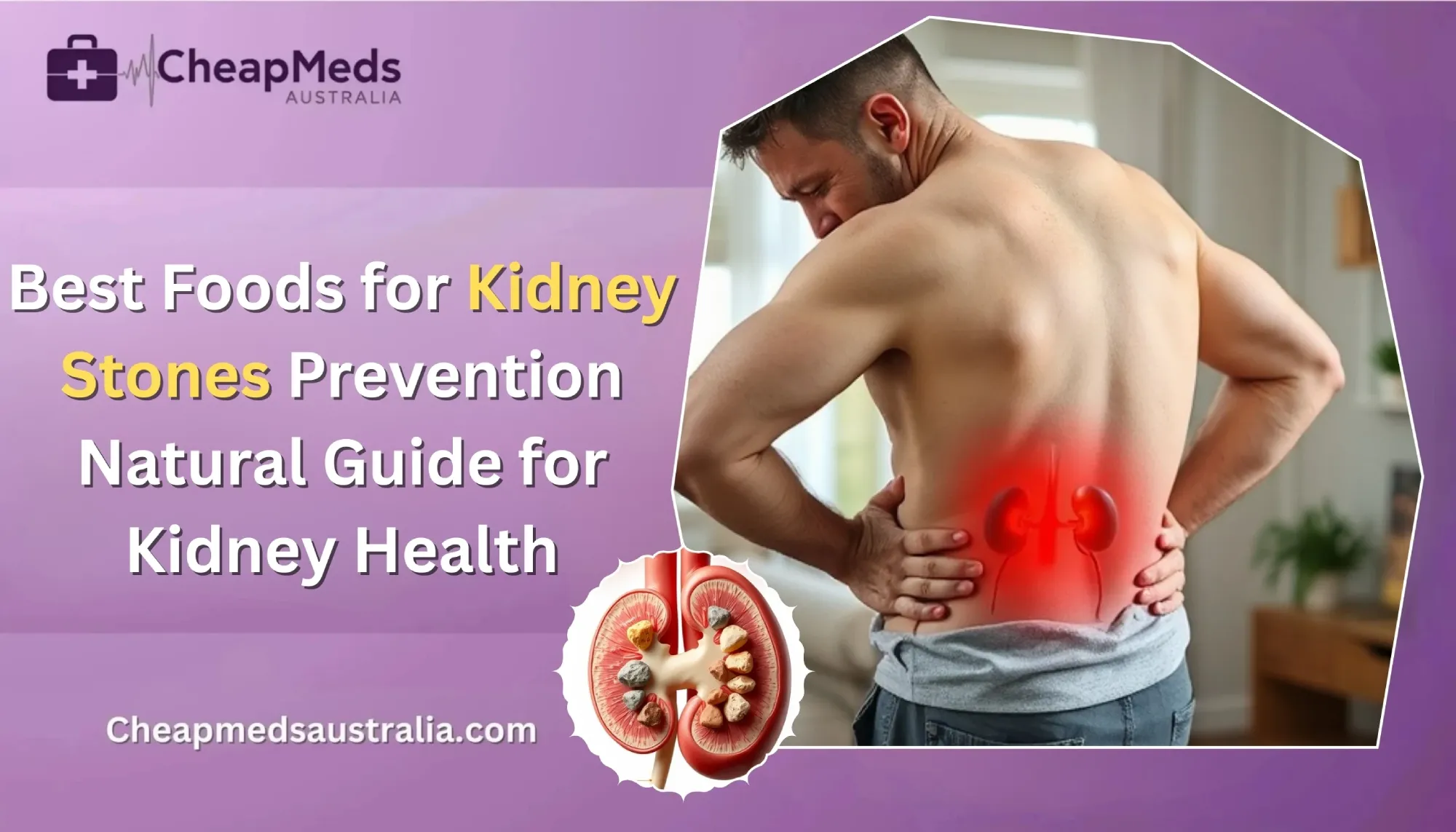 Best Foods for Kidney Stone Prevention – Guide for Kidney Health