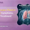 pleural effusion fluid in lungs guide